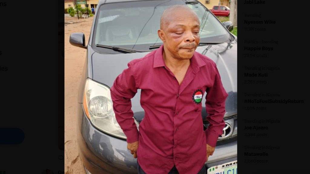 How Imo Governor Sent Thugs, Police to Attack President, Others – NLC