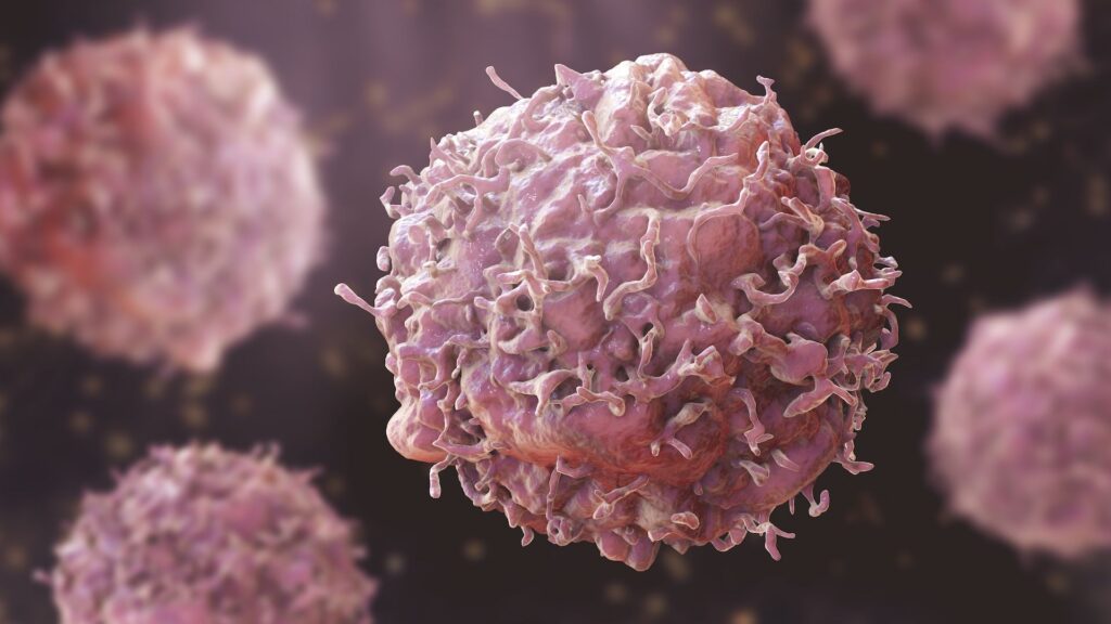 Cancer: Oncologist Urges Early Alarm, Detection